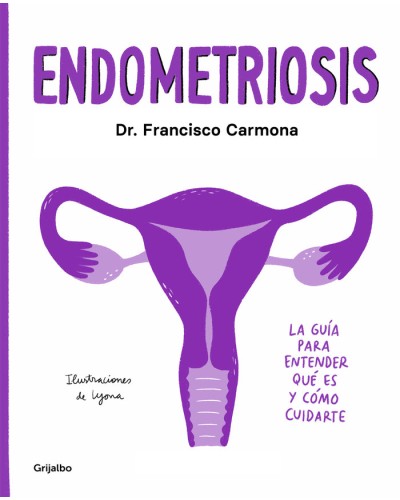 Endometriosis - Dr Francisco Carmona